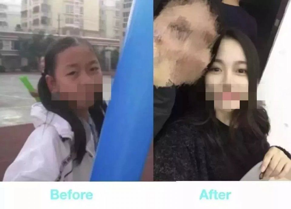 双眼皮“黄金不败宽度”来了!某璐要是早看到也不至于割完眼皮又