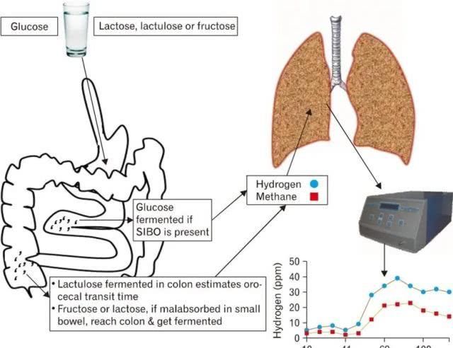  诊断方法■小肠细菌过度增长是什么，如何与它和谐共生？