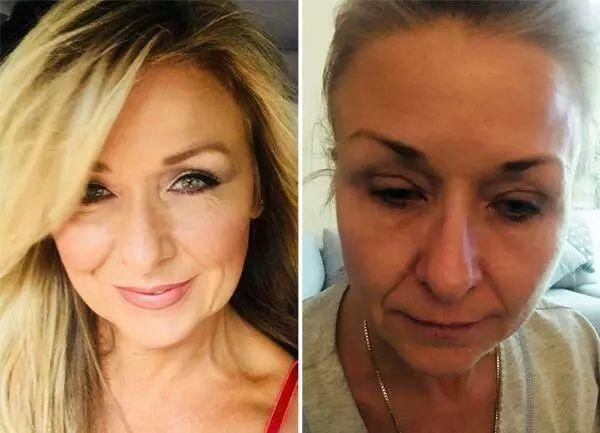 女子25年不卸妆竟长出结石!看完实在令人毛骨悚然……