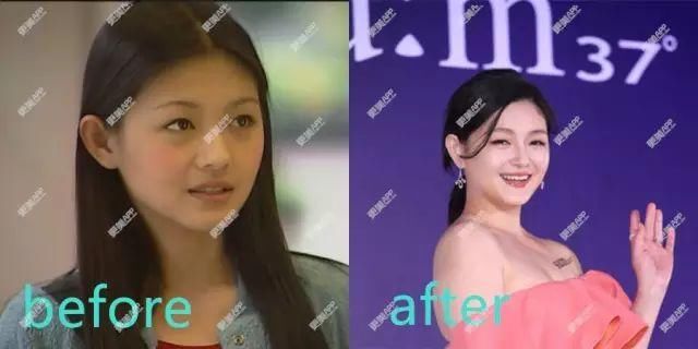 baby用CPB涂全身、林志玲打美白针，女明星为了“洗白”自己有多