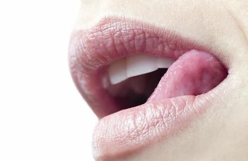  『女生』女生的嘴唇总是有死皮？其实是因为几个原因，不改的话会越来越丑