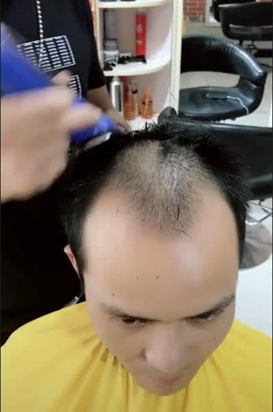 发型决定颜值,这是我见过的最帅的秃头,网友:帅到爆炸!