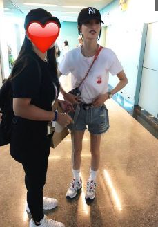 没有张韶涵的筷子腿，就别穿超短裤，杨紫这腿简直不忍直视！