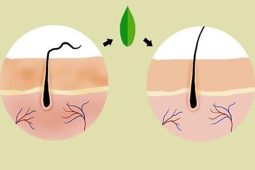 【清理】头皮屑多如雪,怎么都洗不干净?教你一个土方法,摆脱皮屑困扰