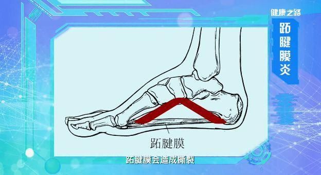 鞋子好不好，脚真的知道!买鞋前记住这3点!