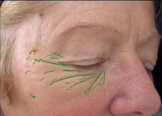 护肤品有效么?抗老怎么做?疯狂剁手的背后原因?答案都在这期BBC里