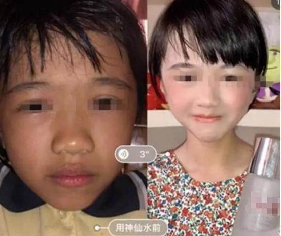  白活@10岁女孩用“神仙水”护肤，前后差别明显，网友：感觉自己白活了