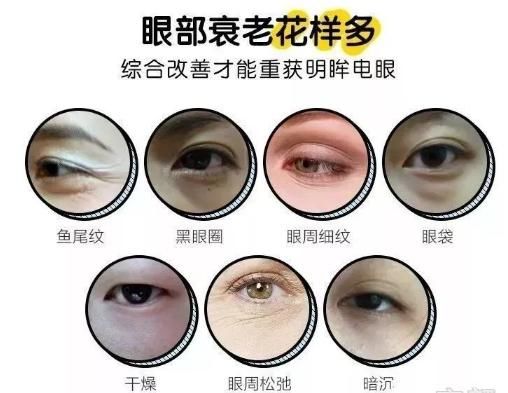  #黑眼圈#有眼周皱纹、黑眼圈眼袋？这些方法帮你改善