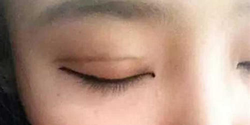 双眼皮是割的还是天生的,看这几点很明显