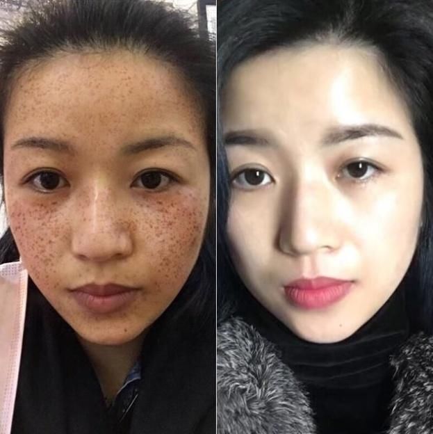 78岁老主任醉酒后无意间透露:牙膏祛斑美白，让你皮肤嫩如鱼豆腐