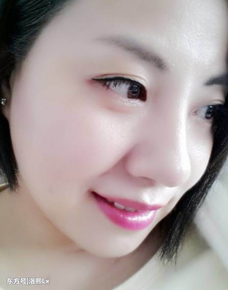 祛斑不在难，睡前红霉素加它擦脸，祛斑美白好多姑娘不知道