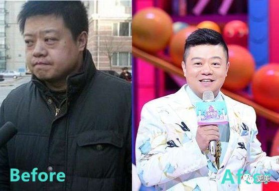 90后的郑爽关晓彤眼袋都要掉地上了，快来个医生救救她们吧!