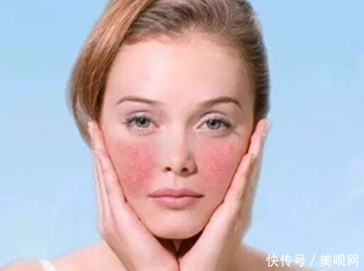 「告别」一换季就烂脸?学会这样做,轻松告别烂脸!