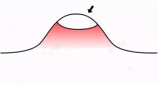 有了“痘”不知道该怎么办？