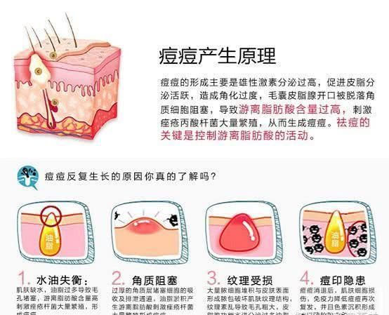  「正确」如何正确的祛痘痘