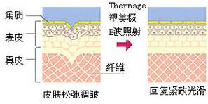 话说抗衰效果惊艳的，Number one深圳联合丽格的热玛吉