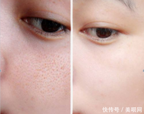 「粗大」还在为毛孔粗大而烦恼吗?集美们,看过来,这样做让你的肌肤细嫩无瑕!