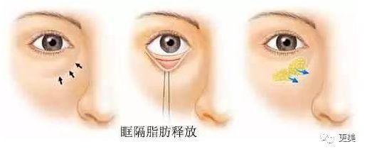 90后的郑爽关晓彤眼袋都要掉地上了，快来个医生救救她们吧!