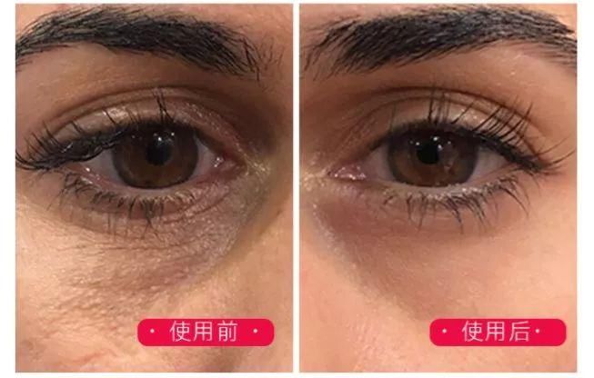 4岁女儿首曝光!34岁可攻可仙的戚薇，如何保住少女颜?