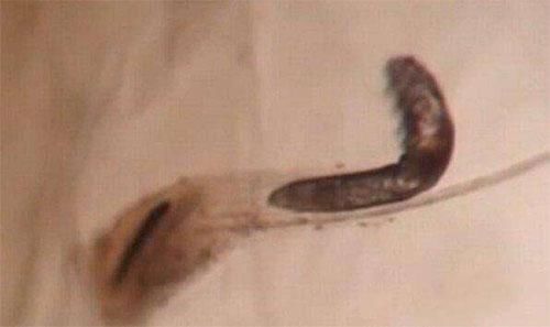 毛孔粗大像小洞，2植物是“毛孔收缩王”，坚持1周，毛孔偷偷变小