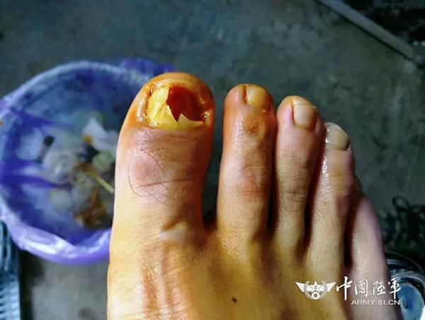 走近中国最西中印边境