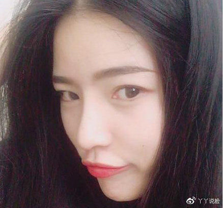  鼻炎@有鼻炎能不能做隆鼻手术?效果好吗？有危险吗？