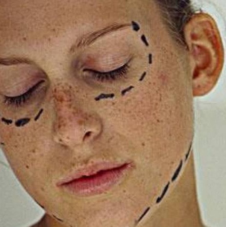 英国姥姥为美，花费11万去做整容，让男朋友有危机感