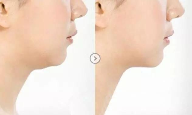 转发杨超越就能心想事成?别迷信了先瘦瘦脸吧