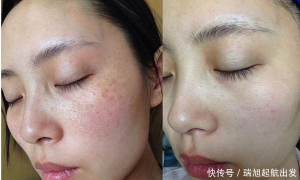  『脸部』蜂蜜加它涂抹脸部，坚持一周色斑淡化皱纹消失，轻松get白嫩肌