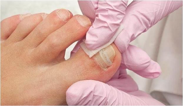 女人的高跟鞋,常穿高跟鞋会引发哪些足部疾患?看完你还敢穿吗?