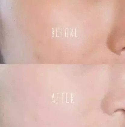 20+的你败给了51岁的周慧敏?这款一抹磨皮神器让你回到18岁。