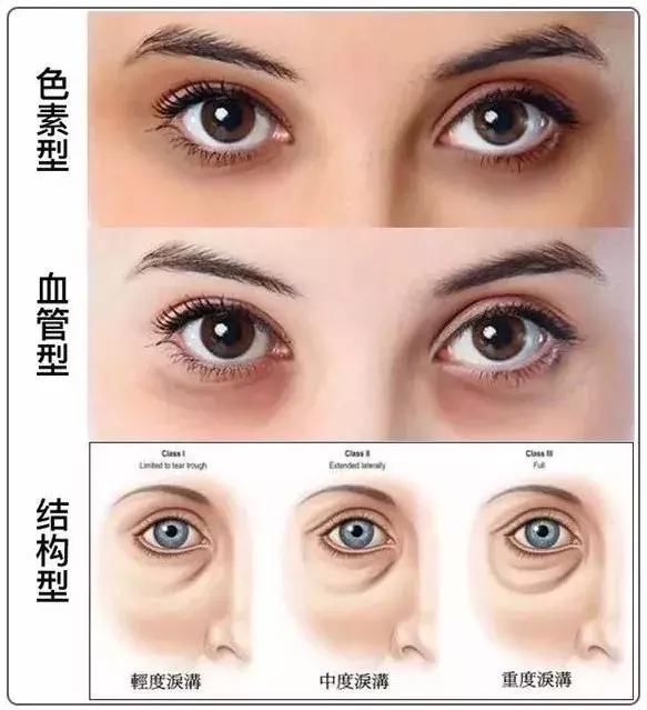 网上疯传的7条护肤谣言，是时候揭穿了！