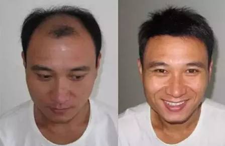 生活里常见的小苏打太多才多艺了，竟然还有如此神奇的好用处！