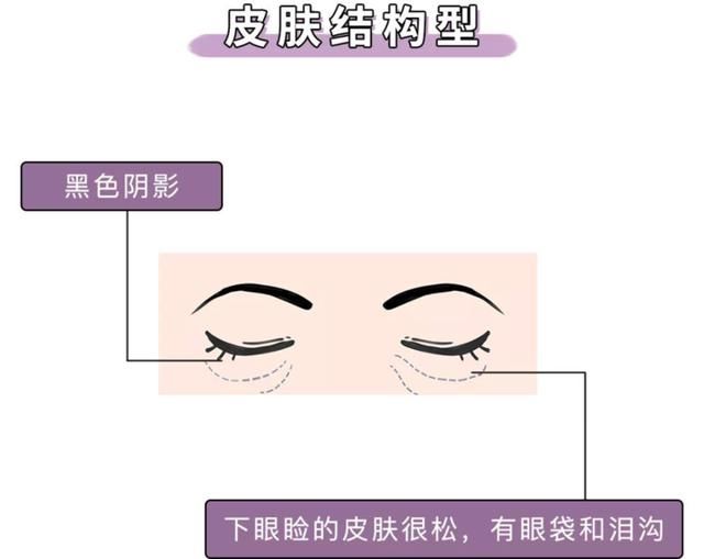  『刷屏』问壹点｜“本人黑眼圈证明”刷屏？壹起扒一扒黑眼圈的前世今生