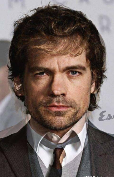 「发育不良」3张 患有残废的大牌明星，史泰龙神经损伤成面瘫，彼得丁克拉格发育不良