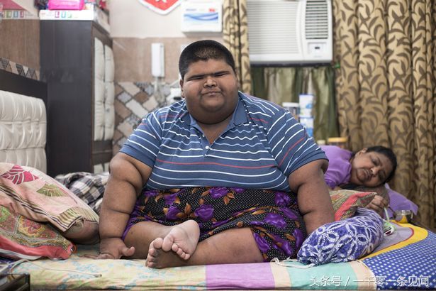 印度14岁小伙体重474斤成世界最胖，看到他爸妈后，这胖的没毛病