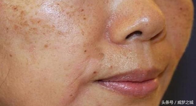 把白醋和生姜放在一起，解决了千万家庭主妇的一个难题，赶紧试试