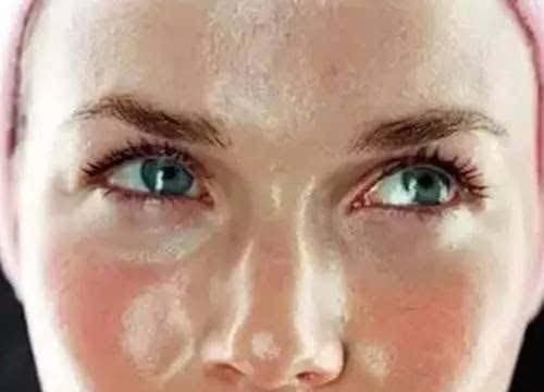 早起脸上3表现，每晚几万条螨虫在你脸上爬，逼走杀光它只需2招