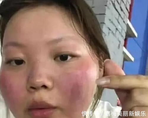 脸部■女生脸部很娇嫩,最怕你做这“3动作”,再不改“脸蛋”会越来越大