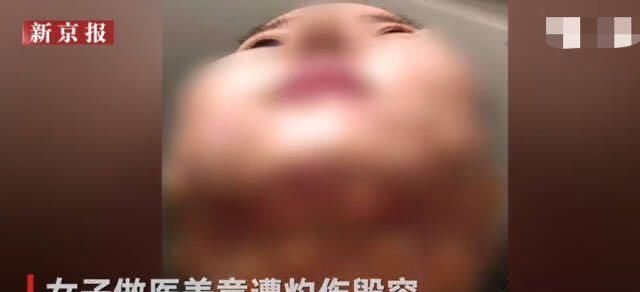  『美容仪』医美护肤品将替代普通护肤品,是真的吗?