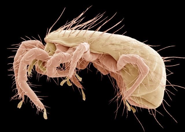 螨虫又脏又臭，脸上会有4大警报，三招让上万螨虫有来无回