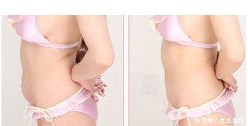  #腰部#腰部吸脂是大手术吗