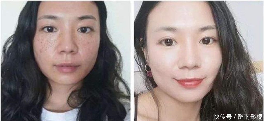 『脸上』女生脸上有色斑,教你一招用生姜加它敷脸,15天轻松告别色斑脸!