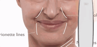 拯救素颜痛点：我是如何让苹果肌再现，法令纹消失的