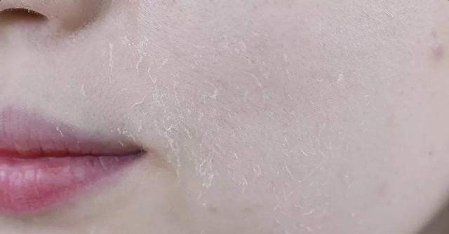  [自知]脸上有这几个征兆，就表示真的要好好护肤了，很多人都不自知！