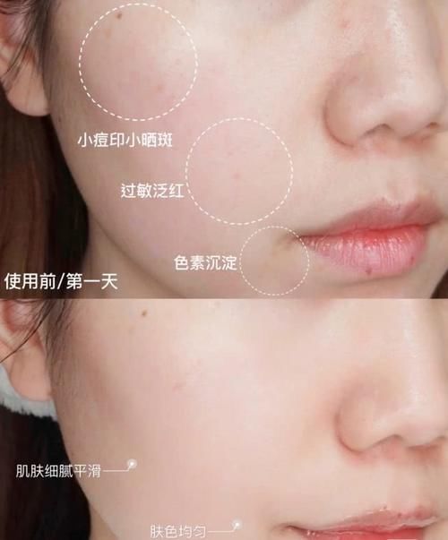 #同龄人#李小冉哪像李沁妈?与90后同框cp感超足,优越美貌彰显不俗年轻态