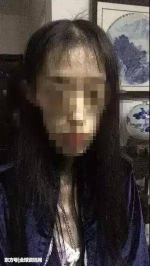 自杀式减肥--21岁女孩从110斤瘦到50斤，数着米吃饭!