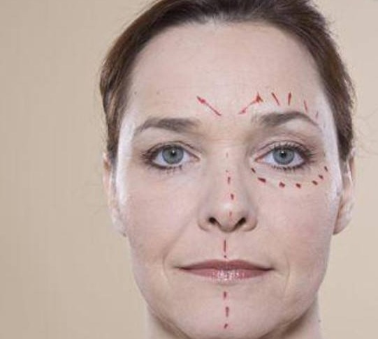 英国姥姥为美，花费11万去做整容，让男朋友有危机感