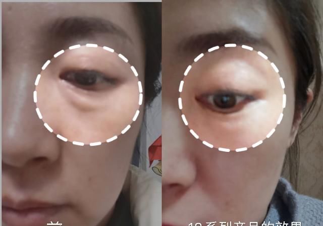  百科@瘦百科18小黑盒：遮不住的眼袋到底该怎么办？