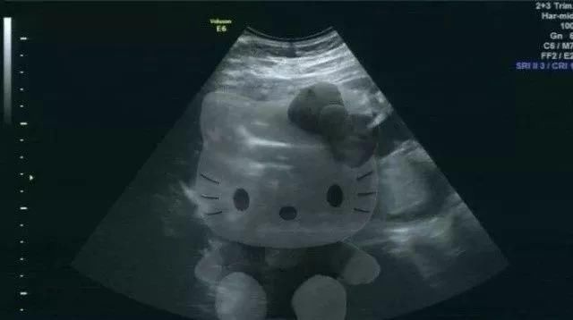 给男朋友发消息说"我好像怀孕了"，网友的评论太精彩了